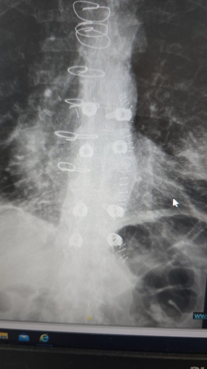 אסותא אשדוד