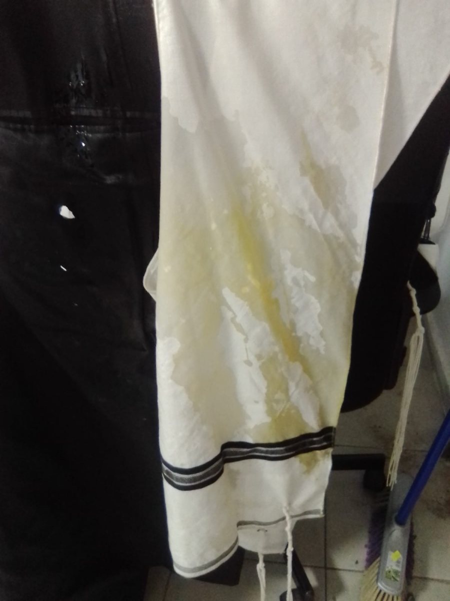 הציצית המוכתמת מהביצה שהוטחה באברך החסידי