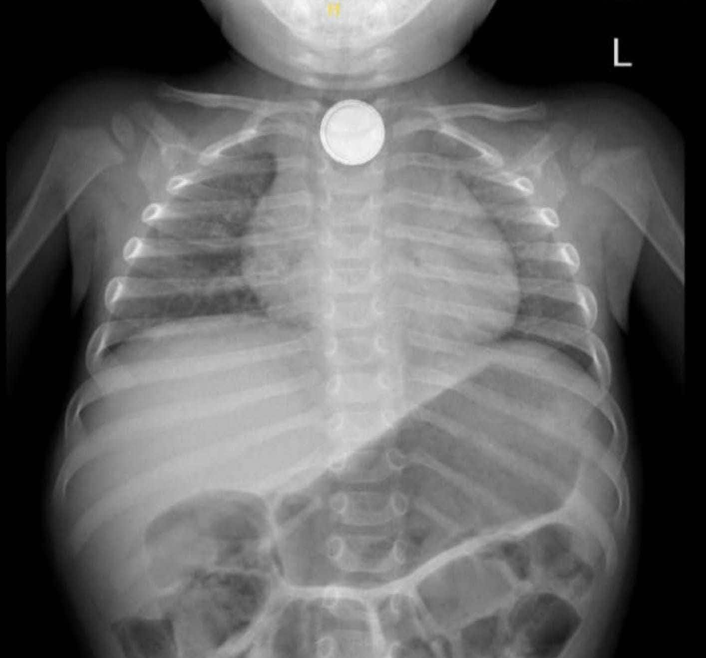 צילום הרטנגן. אסותא אשדוד