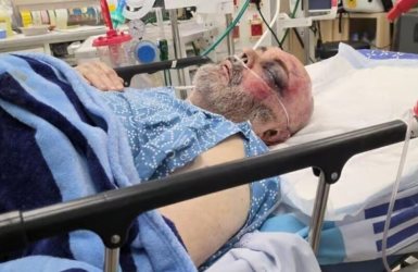בוריס קוניק עדיין מאושפז לאחר התקיפה החמורה