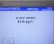 רוכב אופניים חשמליים נתפס בבת ים עם כמות חריגה של אלכוהול בגופו