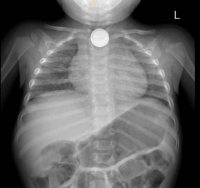 צילום הרטנגן. אסותא אשדוד