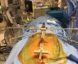 הדסה: ניתוח פורץ דרך עולמי לקיבוע שבר בעמוד השדרה 