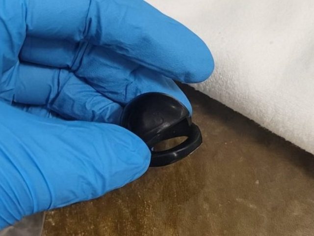 חתיכת הצעצוע אותה בלעה התינוקת (צילום: מד"א הצלה דרום)